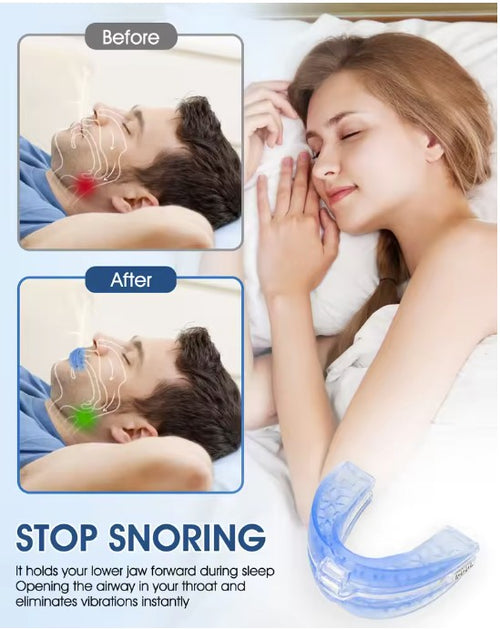 Adjustable Box Anti-Snoring Sleep Aid Mouth Guard